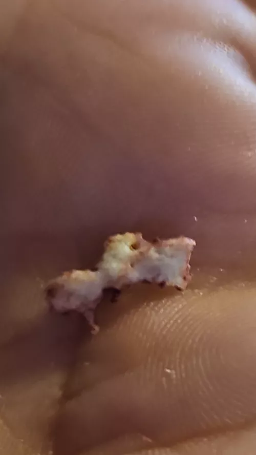 Just pulled this out of my gums post molar extraction!