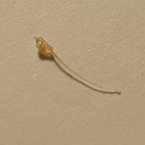 Popped this out of my pubic area. Clogged pore