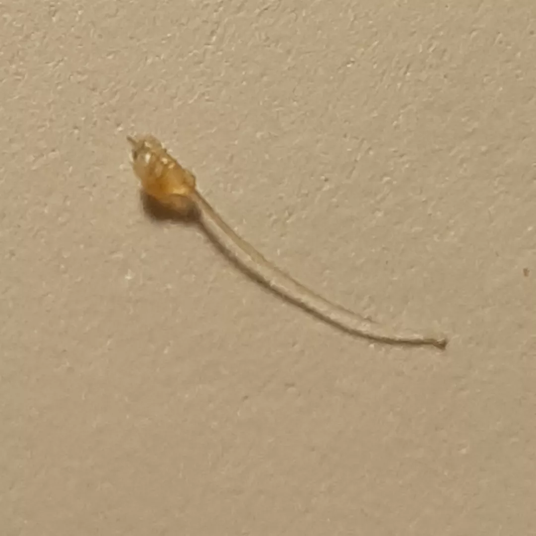 Popped this out of my pubic area. Clogged pore
