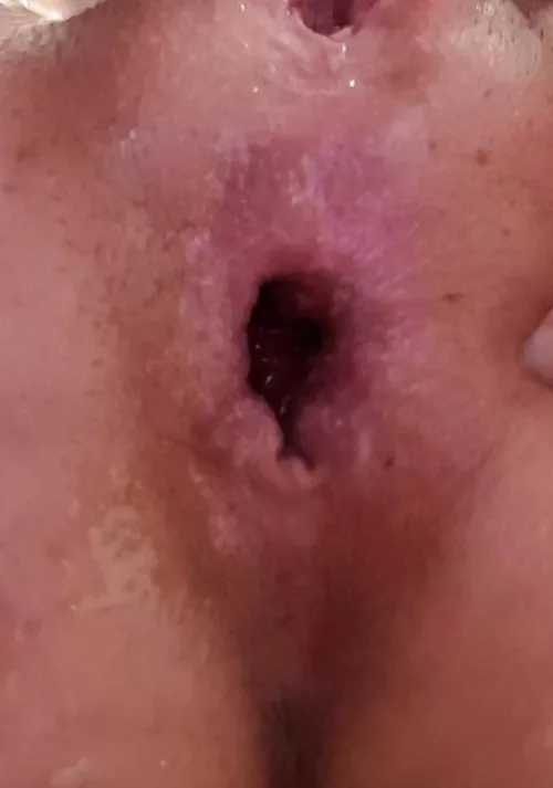 After my first few weeks of anal training... Finally opening