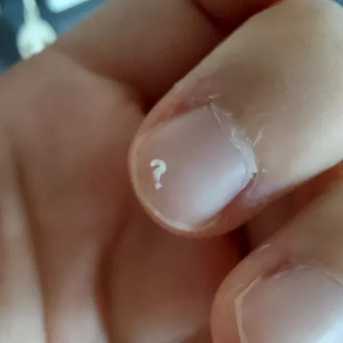 Pls ignore my dry ass skin