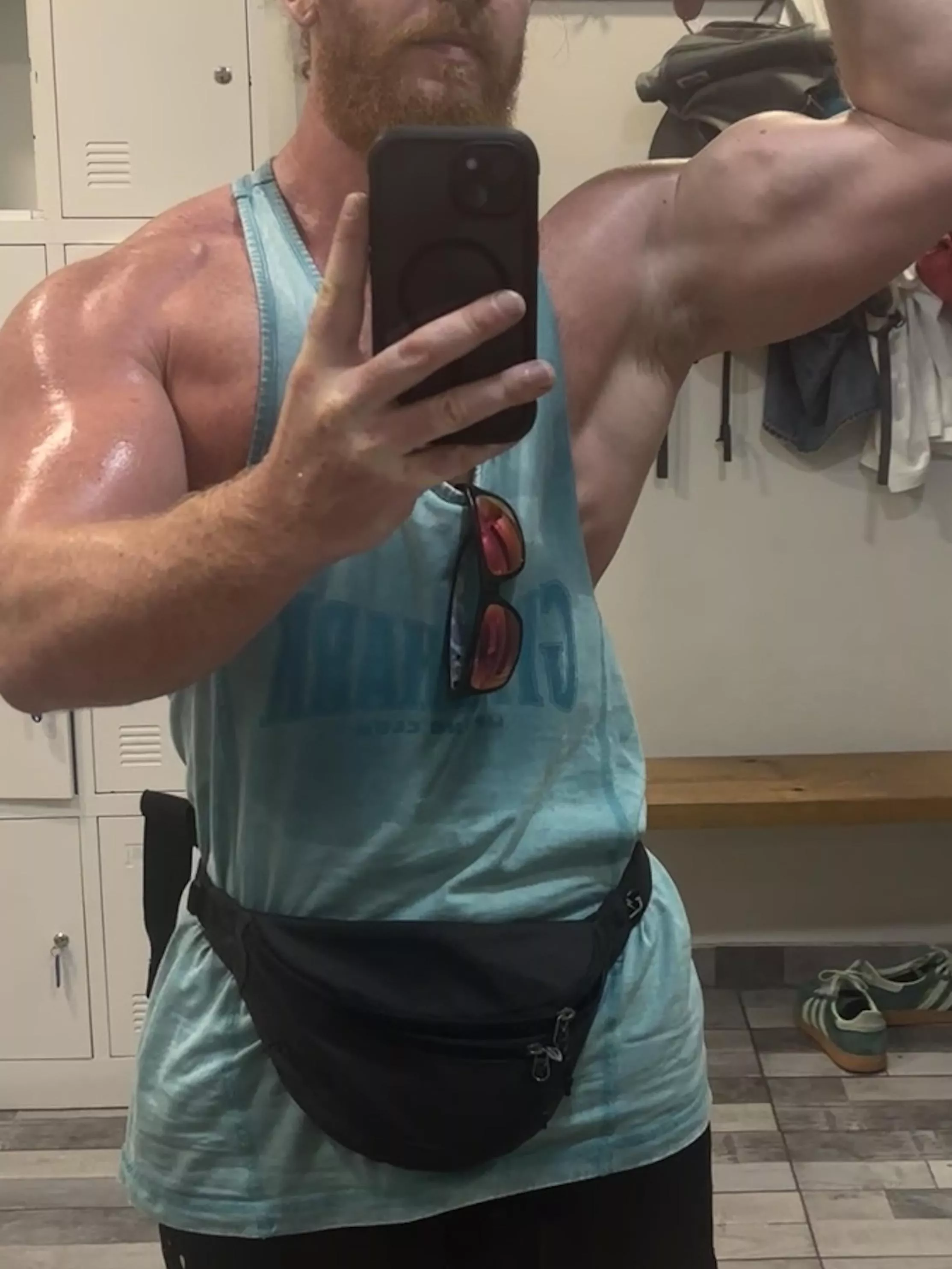 Super sweaty arm pit