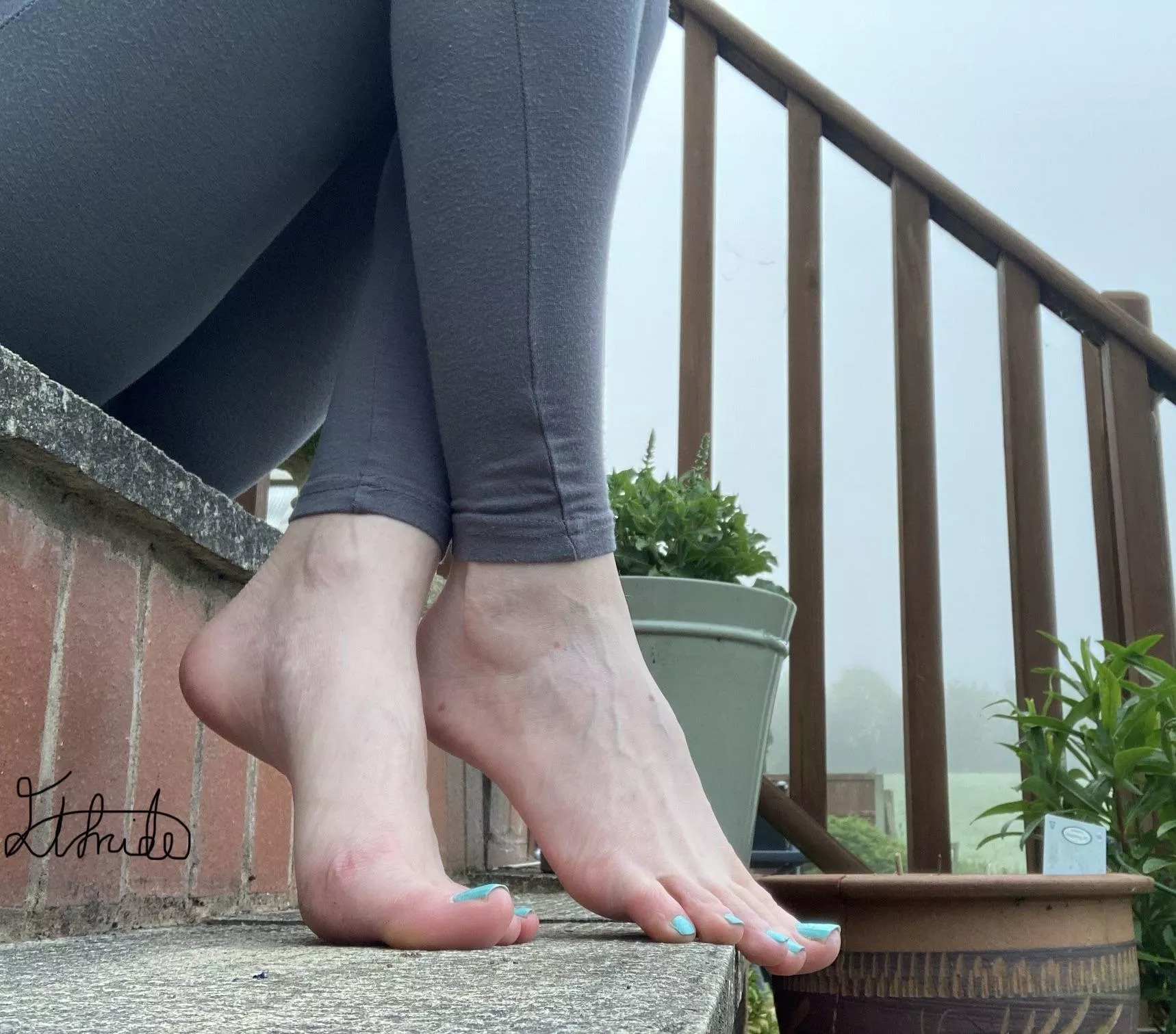 High arches or blue pedi?