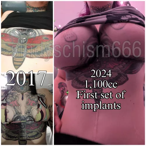 2017 vs 2024 1,100cc implants first set. The top photo I was barely an A cup. The bottom I was a little heavier so I had more boobs. Now I'm a 32N cup. Hoping to double 🙏🏻