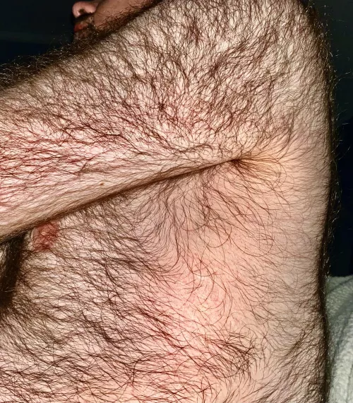 Who else has chest hair that connects to their back hair?
