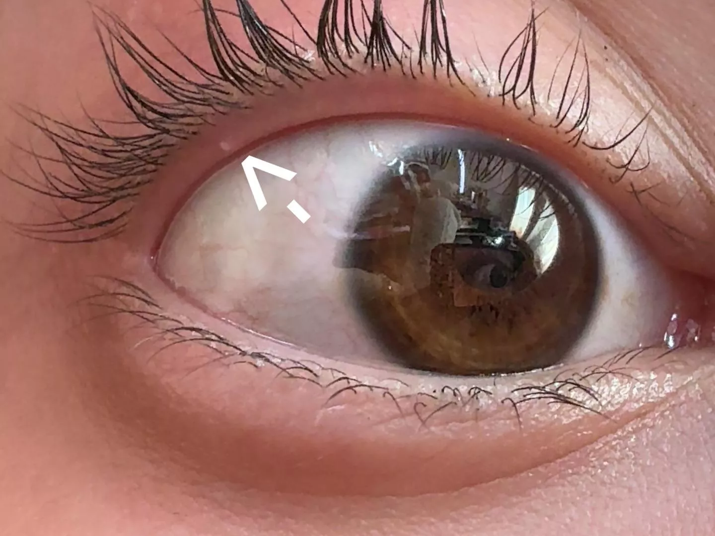 Forbidden pop 😣 I want to pop it so bad bc its just there 