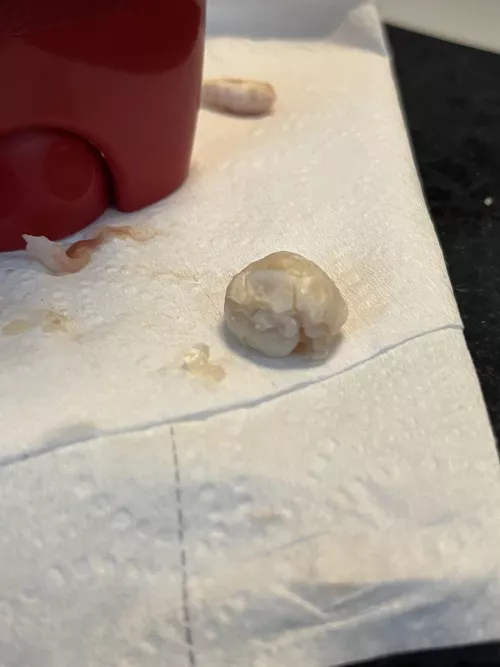 This Came Out of My Ear