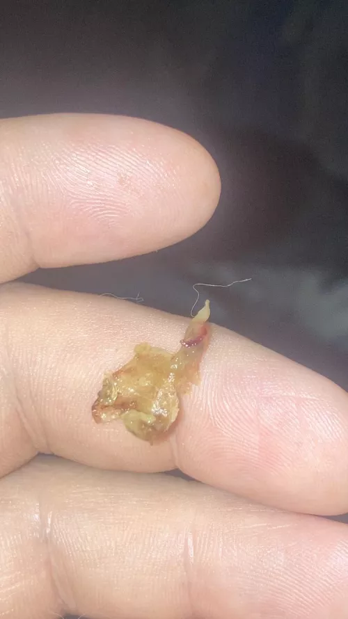 Woke up two o’clock this morning with crazy sinus pain and blew this beast out