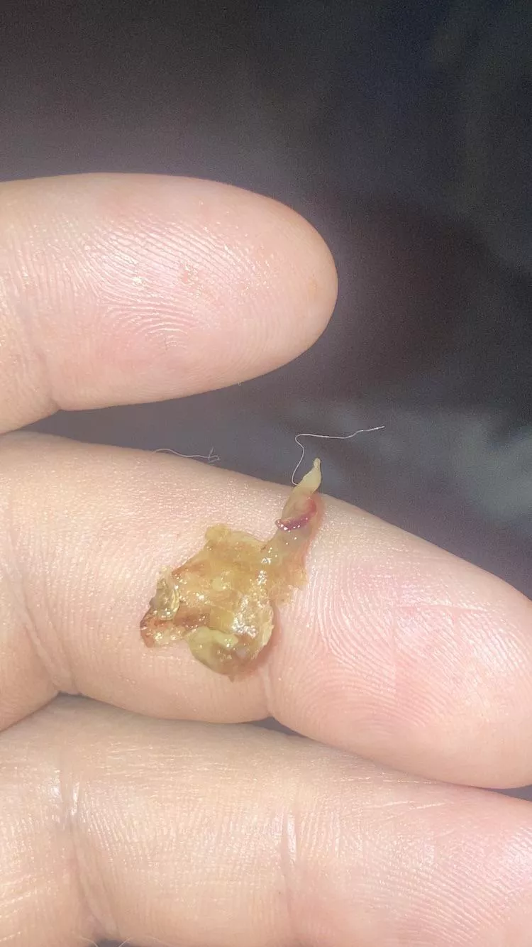 Woke up two o’clock this morning with crazy sinus pain and blew this beast out