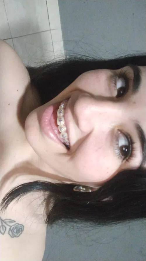 What do you think this little face with braces can do to you?