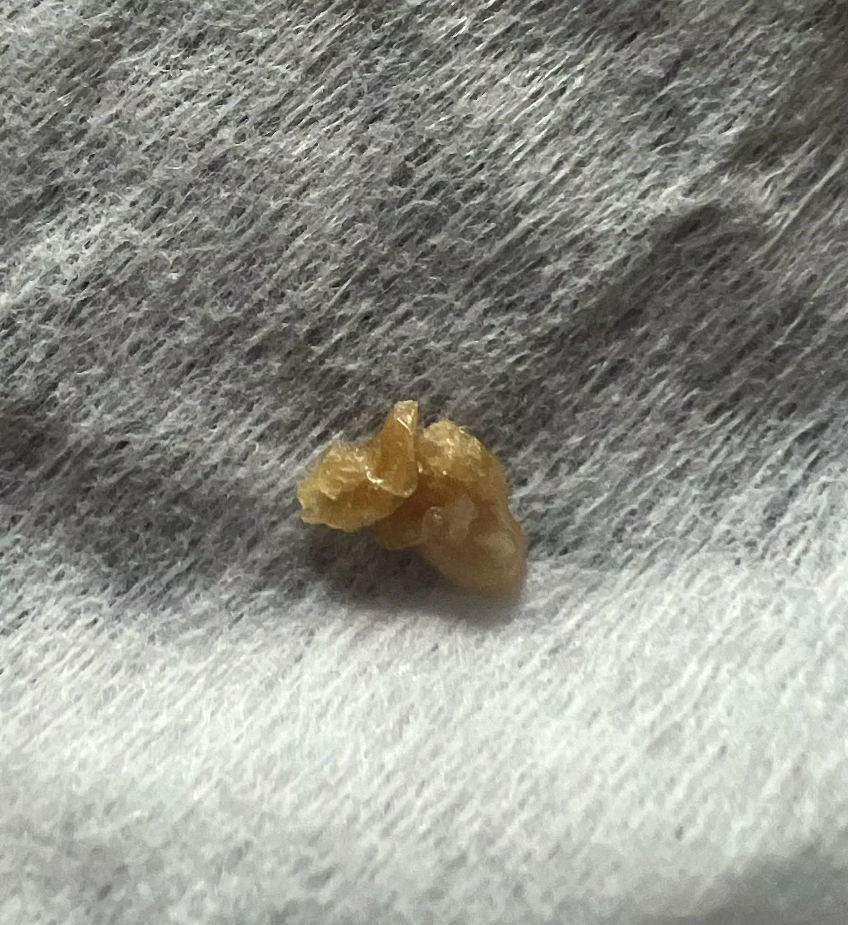 Plucked this out of my 9 month old’s nose this morning