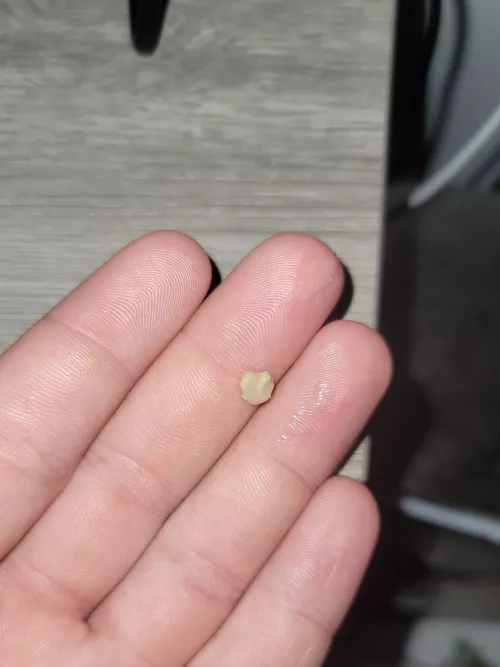 Woke up to this moster sitting in the back of my throat