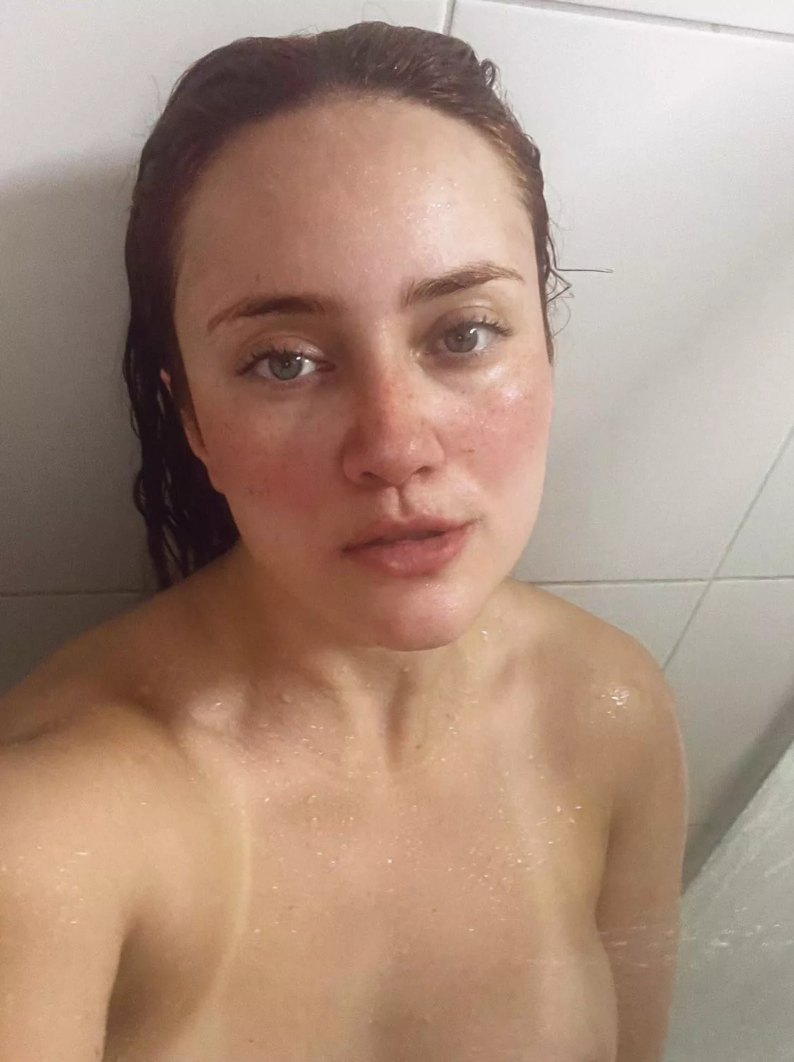 [IRTR] freckles and nothing else