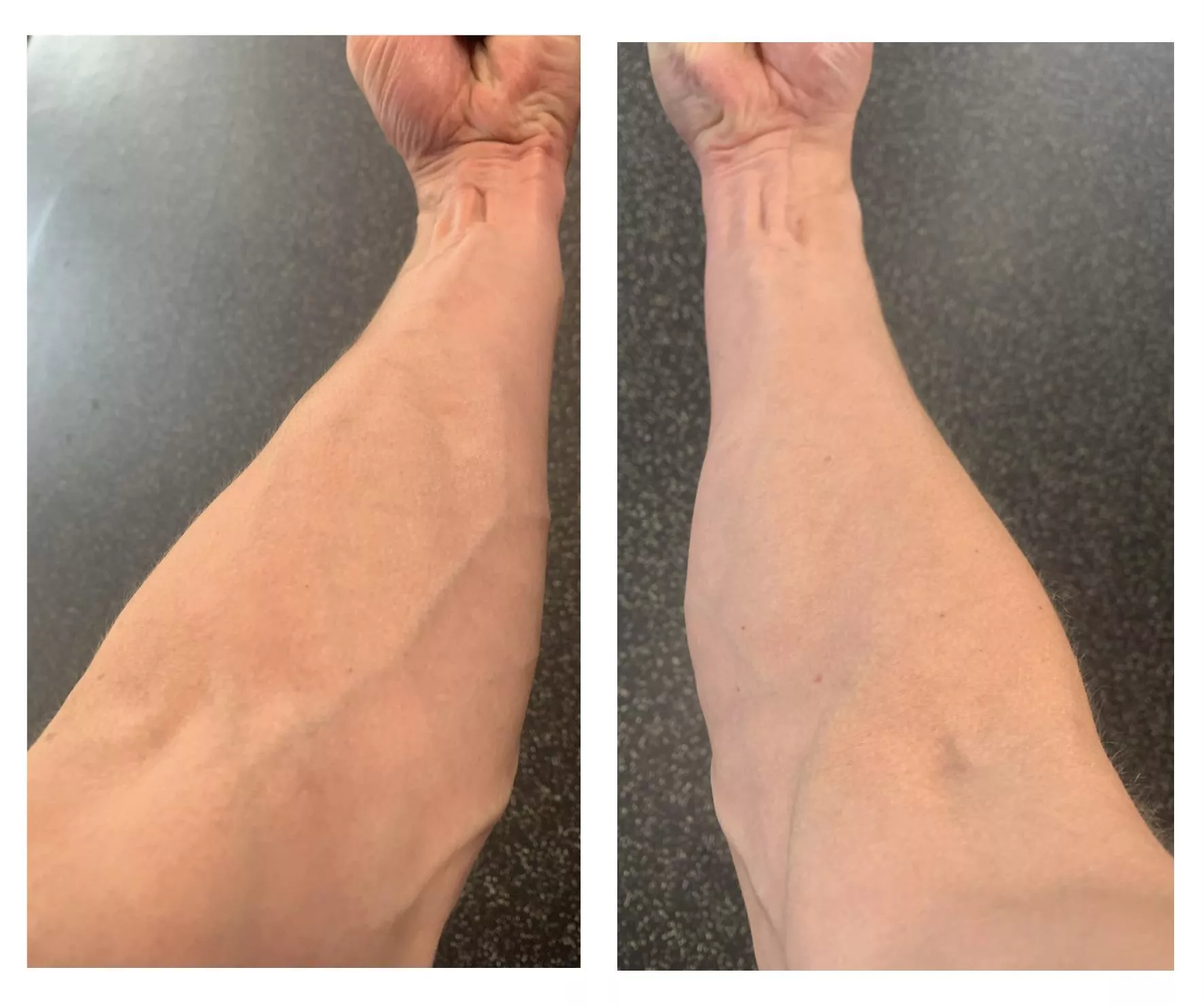 Nurses tell me they love me all the time. Must be for my charming personality.