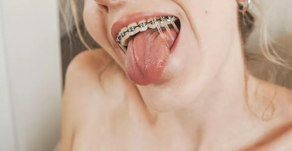 Black bands + lots of elastics is my favorite combo 🖤