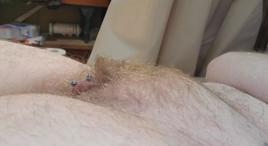 are hairy ginger mounds your thing?