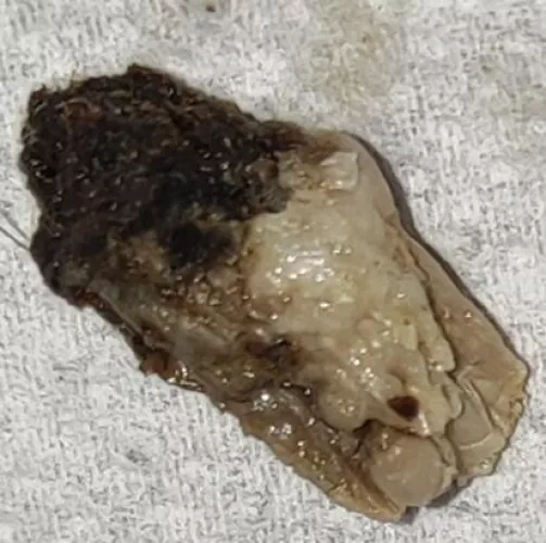 At least decade since belly button cleaned. Not for the weak hearted!