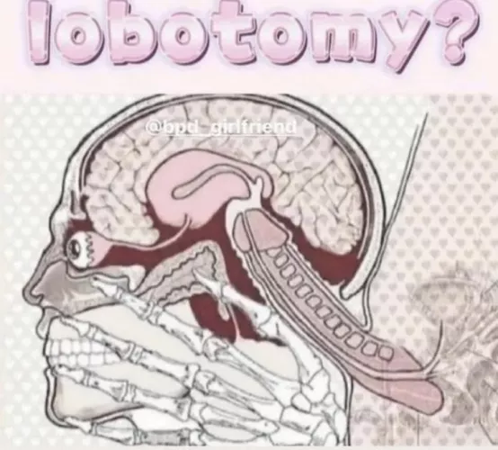 Lobotomy