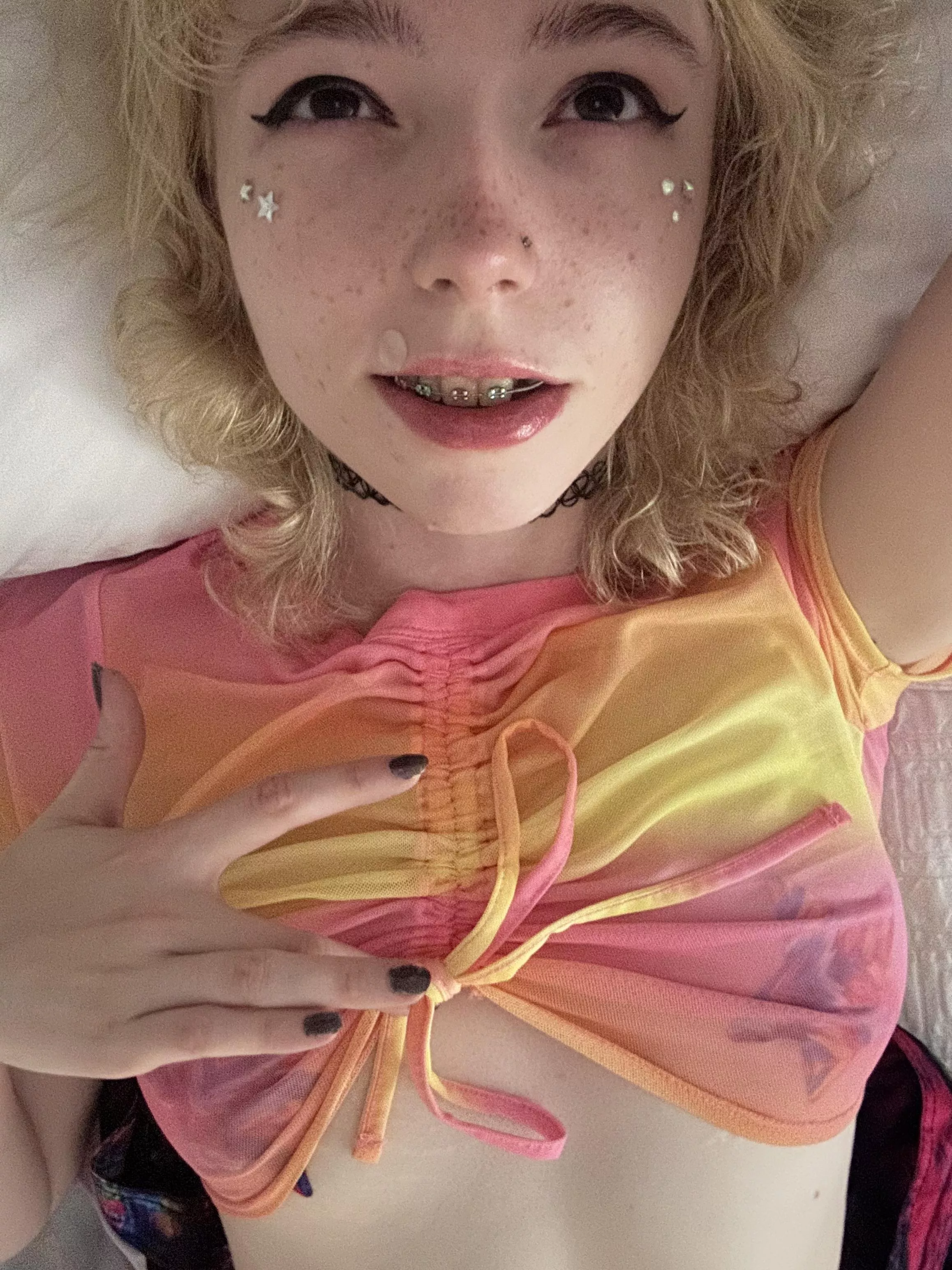 my colorful braces complete my colorful outfit :3