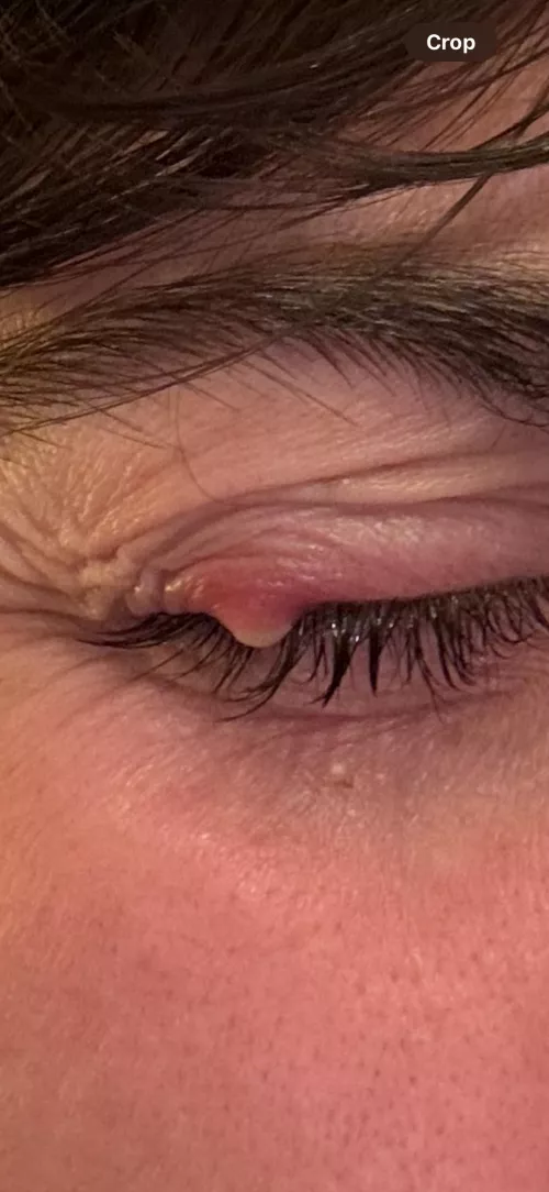 The relief id feel 😮‍💨