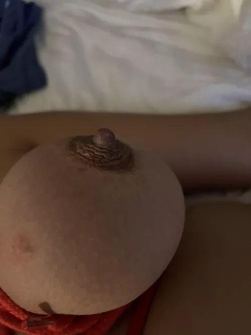 After the suction cups removed.