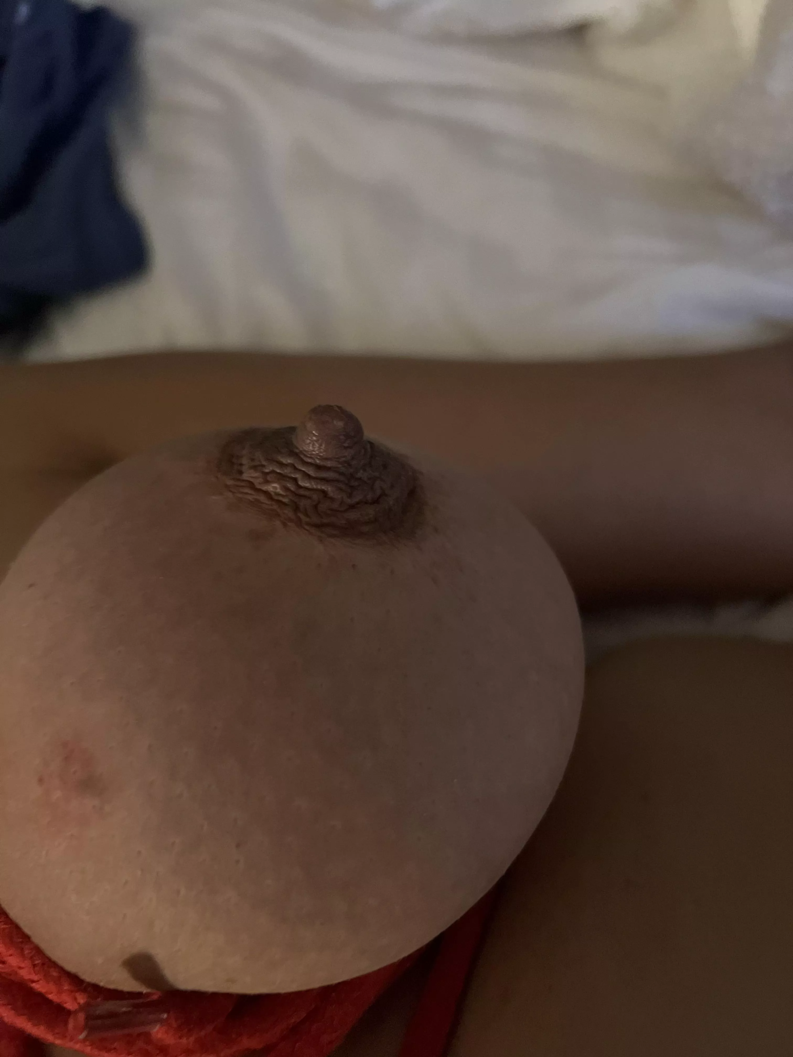 After the suction cups removed.