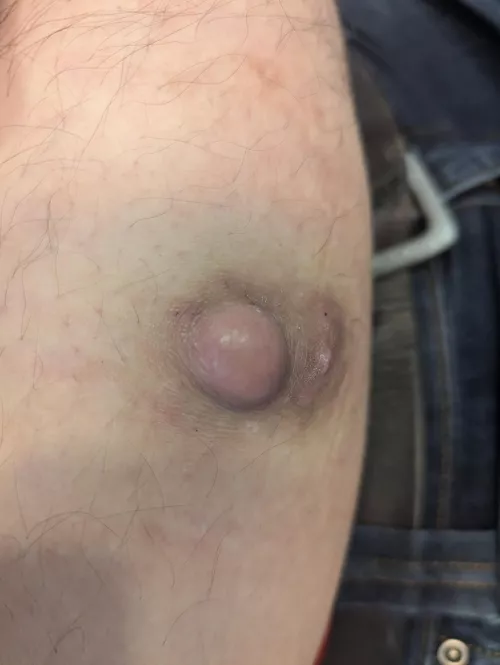 Getting this guy removed today