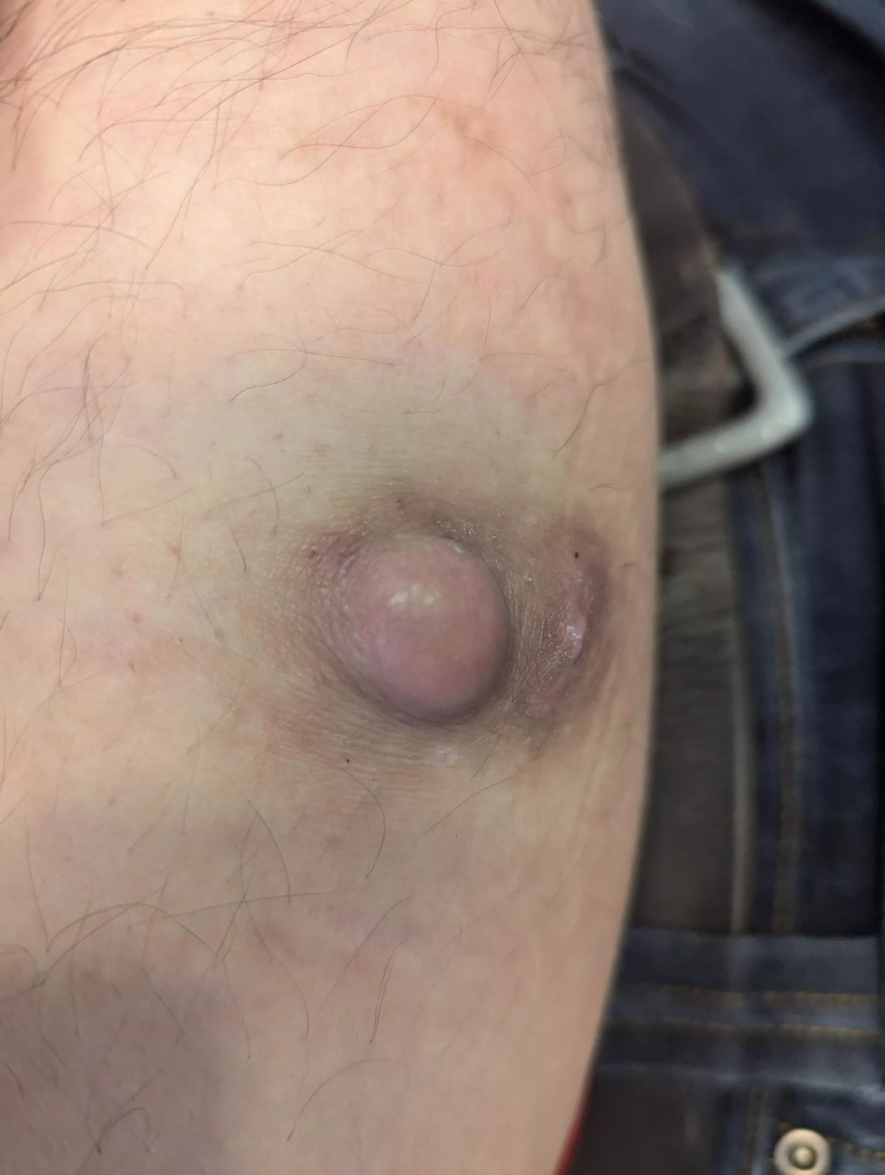 Getting this guy removed today