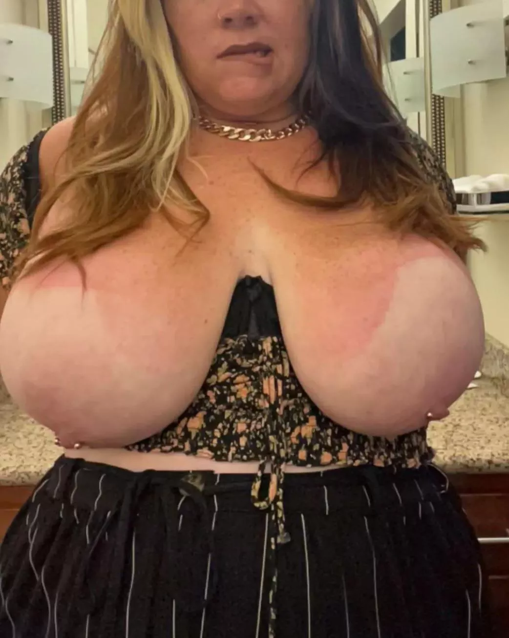 Stayed in the sun a bit too long. I need help with the aloe. 🥵🖤♥️