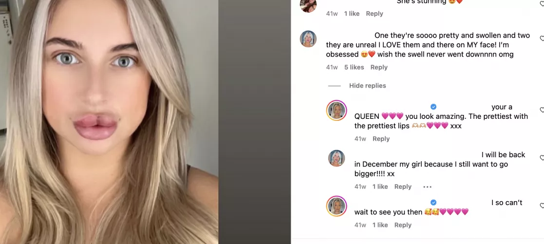 1.5ml in JUST the top lip