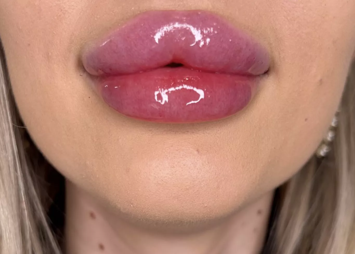 Straight off the needle