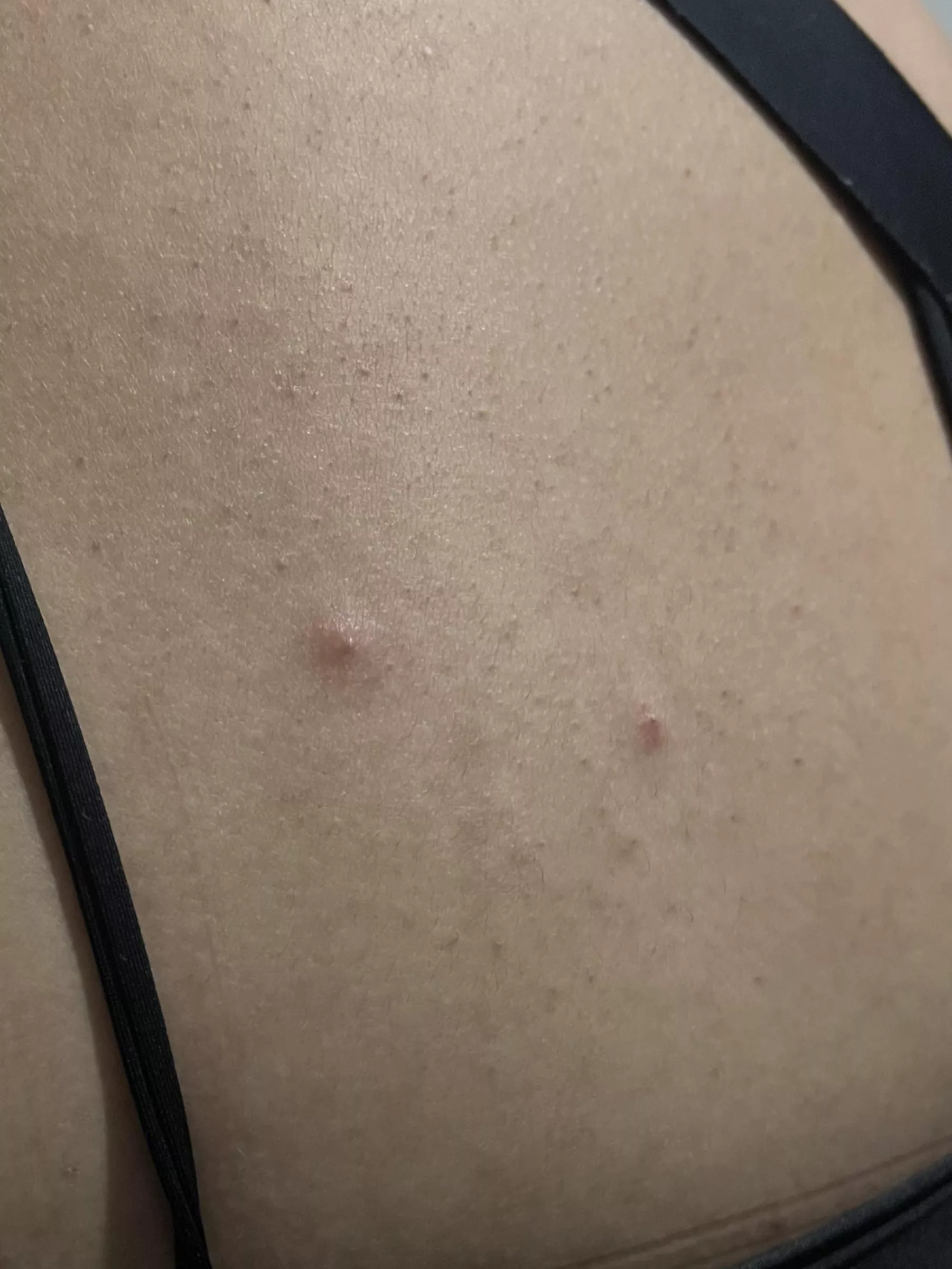 These are really gonna hurt