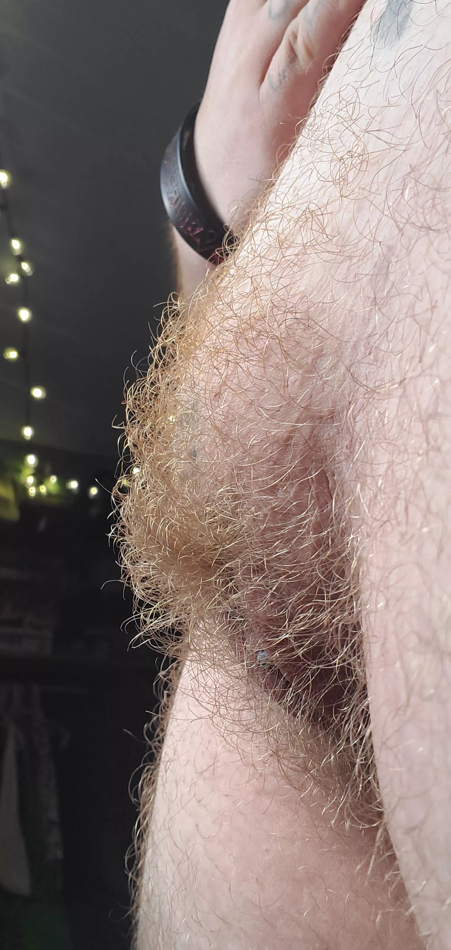 Hairy mound