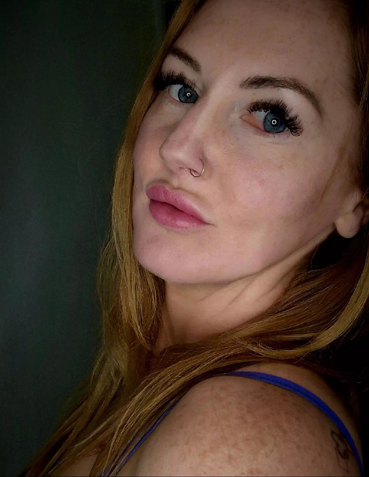 Freckly shoulders [IRTR]