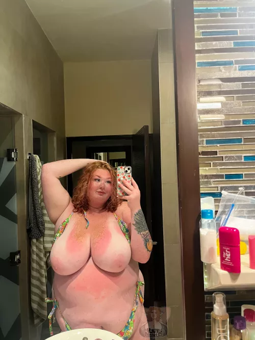 help me apply aloe? 🥵