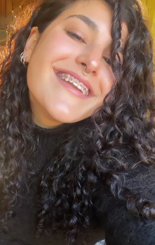 I think braces are sexy