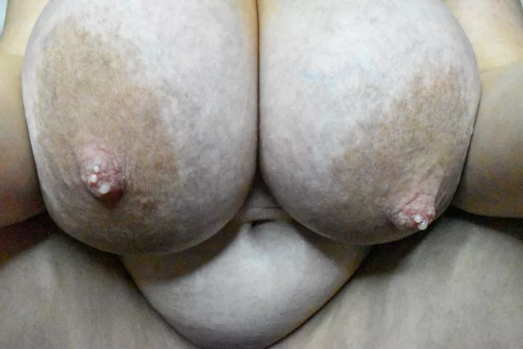 So swollen they’re about to burst! Haven’t pumped all morning 😏