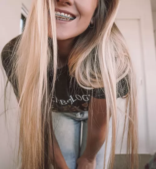 There’s no smile better than a braces smile 😆 Prove me wrong!