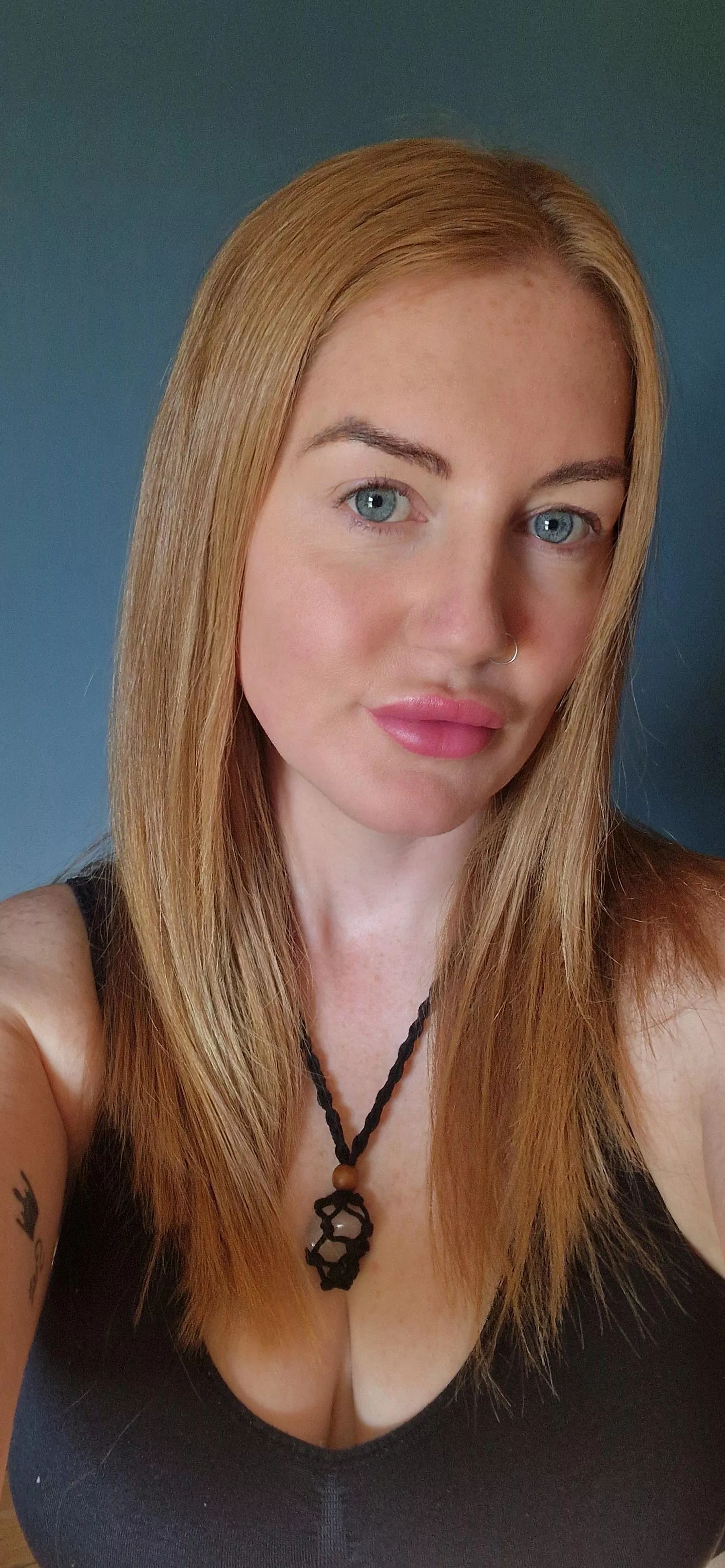 Iv been sun-kissed [IRTR]