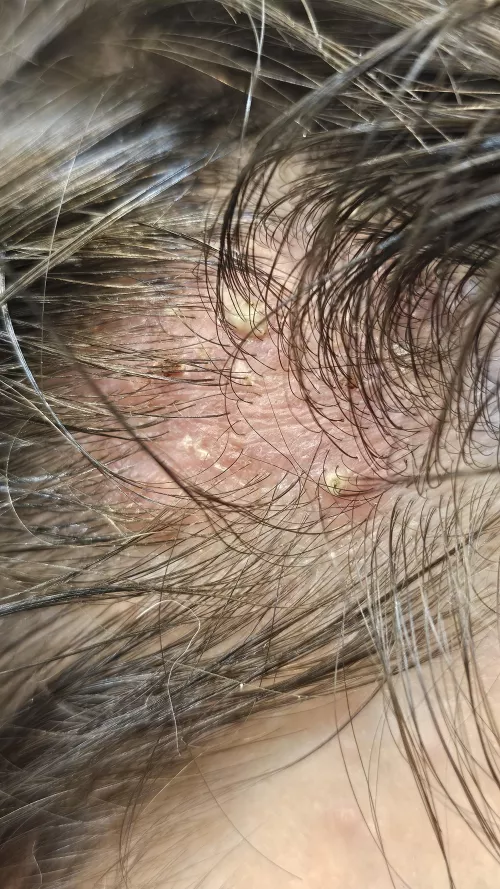 Doc says I can't pop sorry guys trust me I want to...