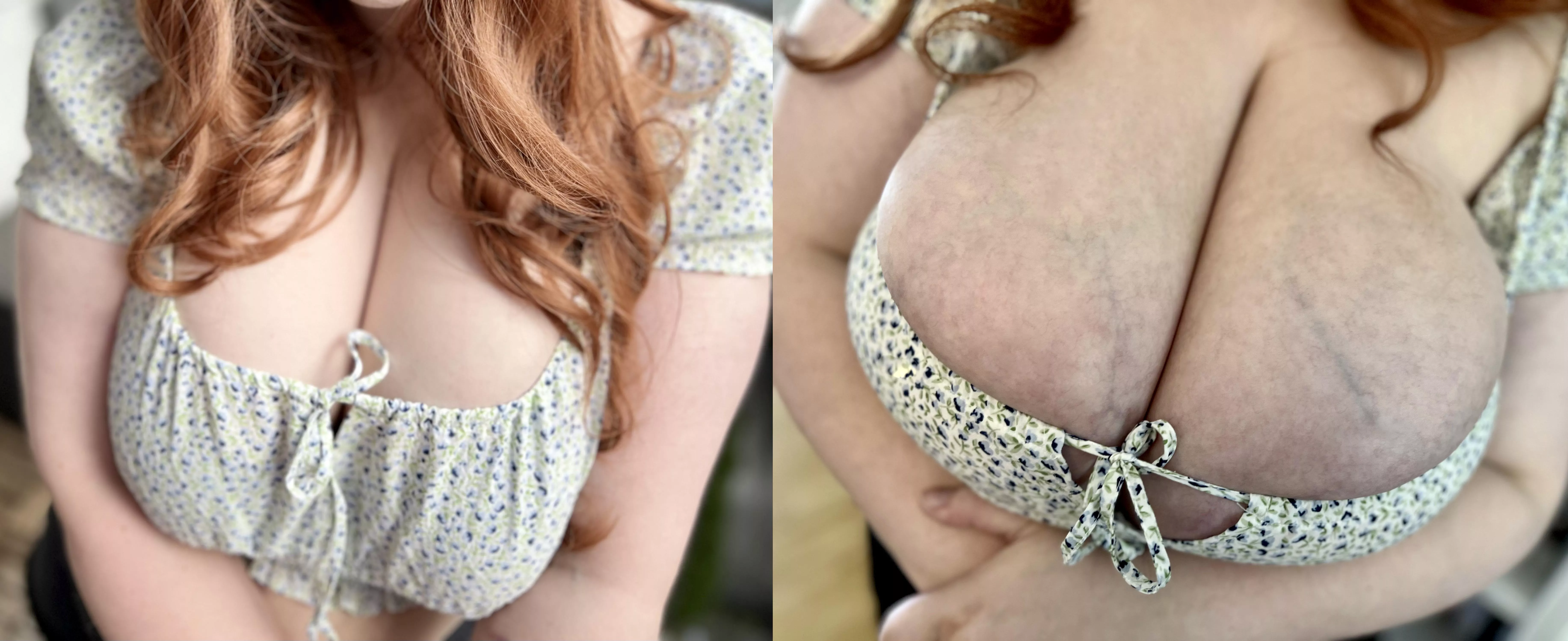 They’re getting bigger and more swollen by the day