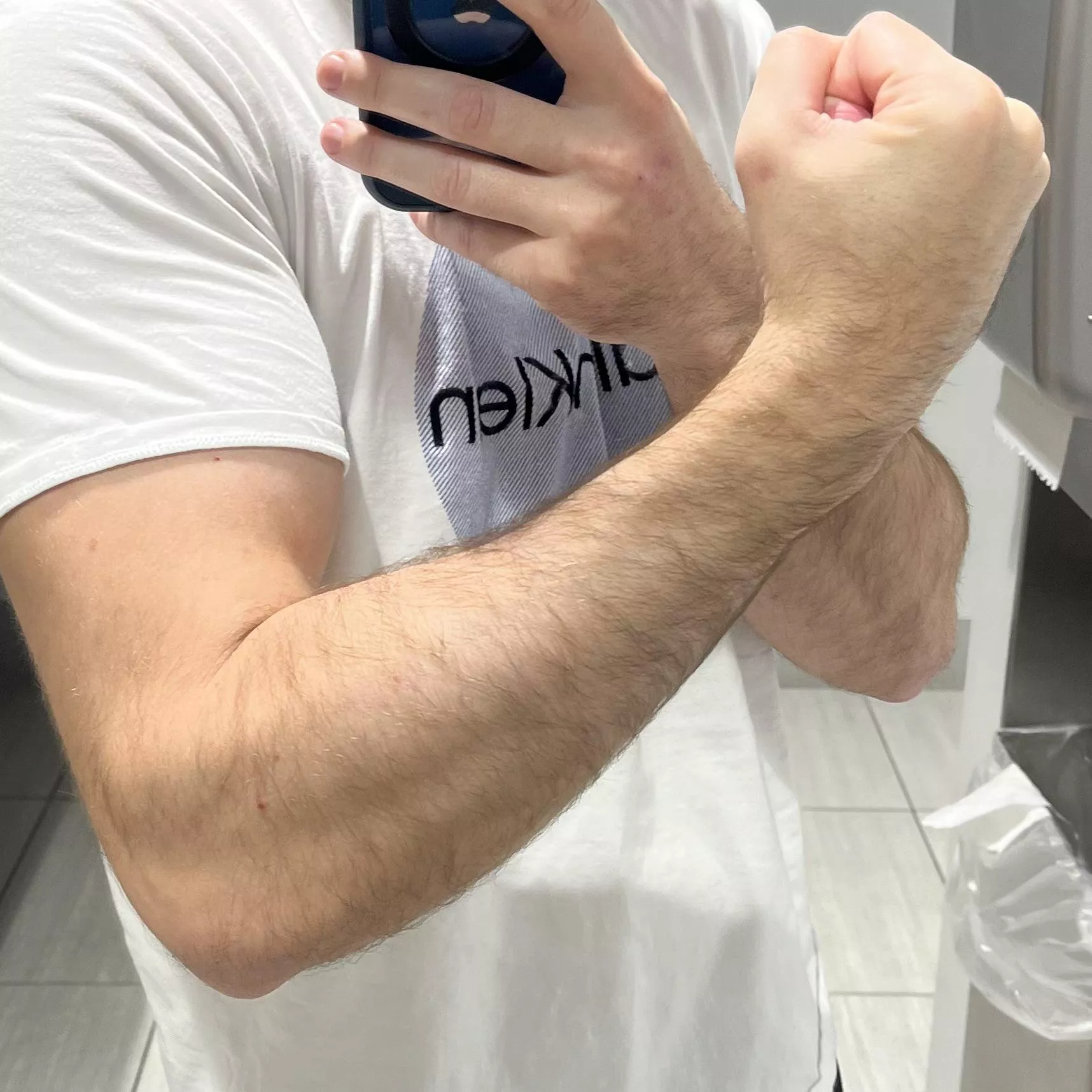 Can you see the striations in my forearms?