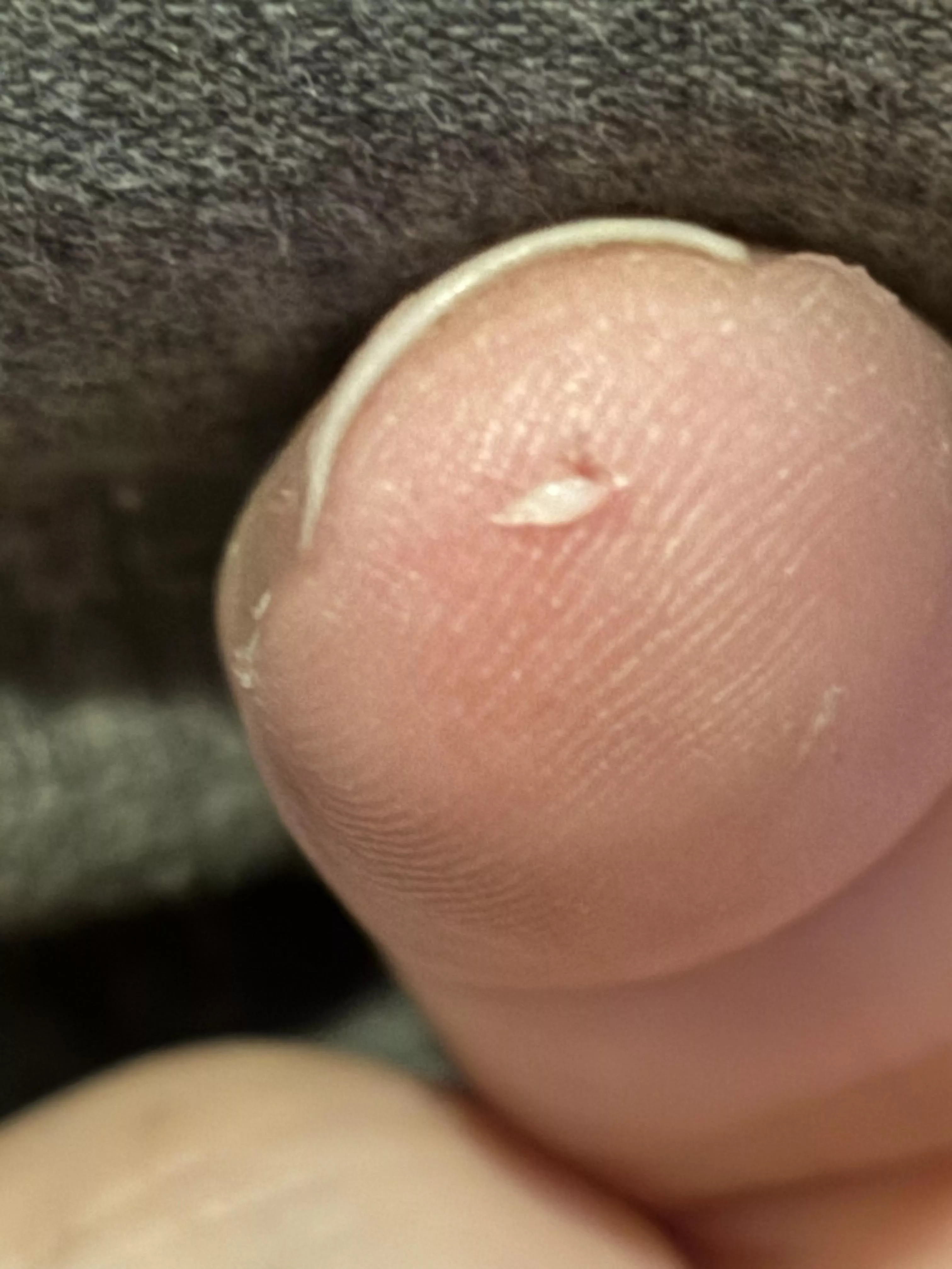 I get these weird angry hair follicles…