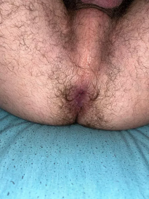 [21] Hairy Bottom anyone? DMs open