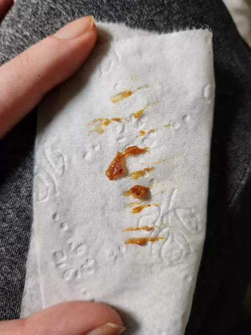 Woke up with some ear wax blocking my hearing, spoiler just because it's gross