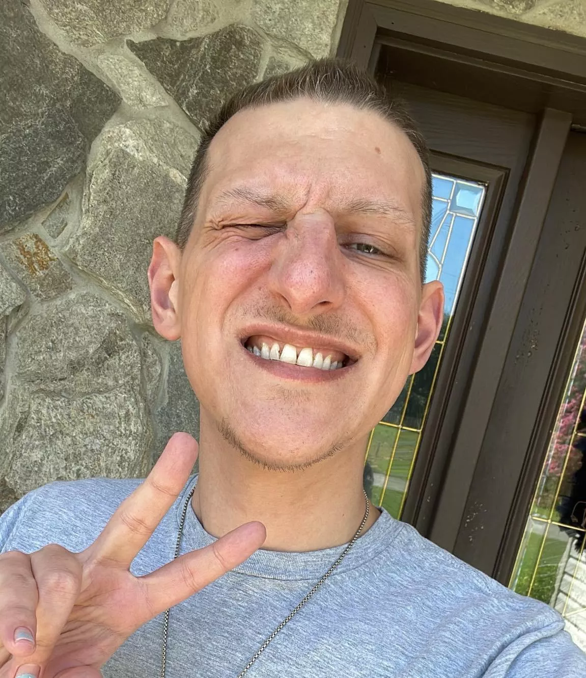 32M After 2 years of chemo, surgeries, radiation- let me reintroduce myself. Hey, I’m Dean