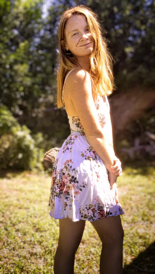 Freckle flash: Naturally brilliant💥 [F27]