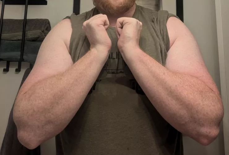 How about some freckles? 