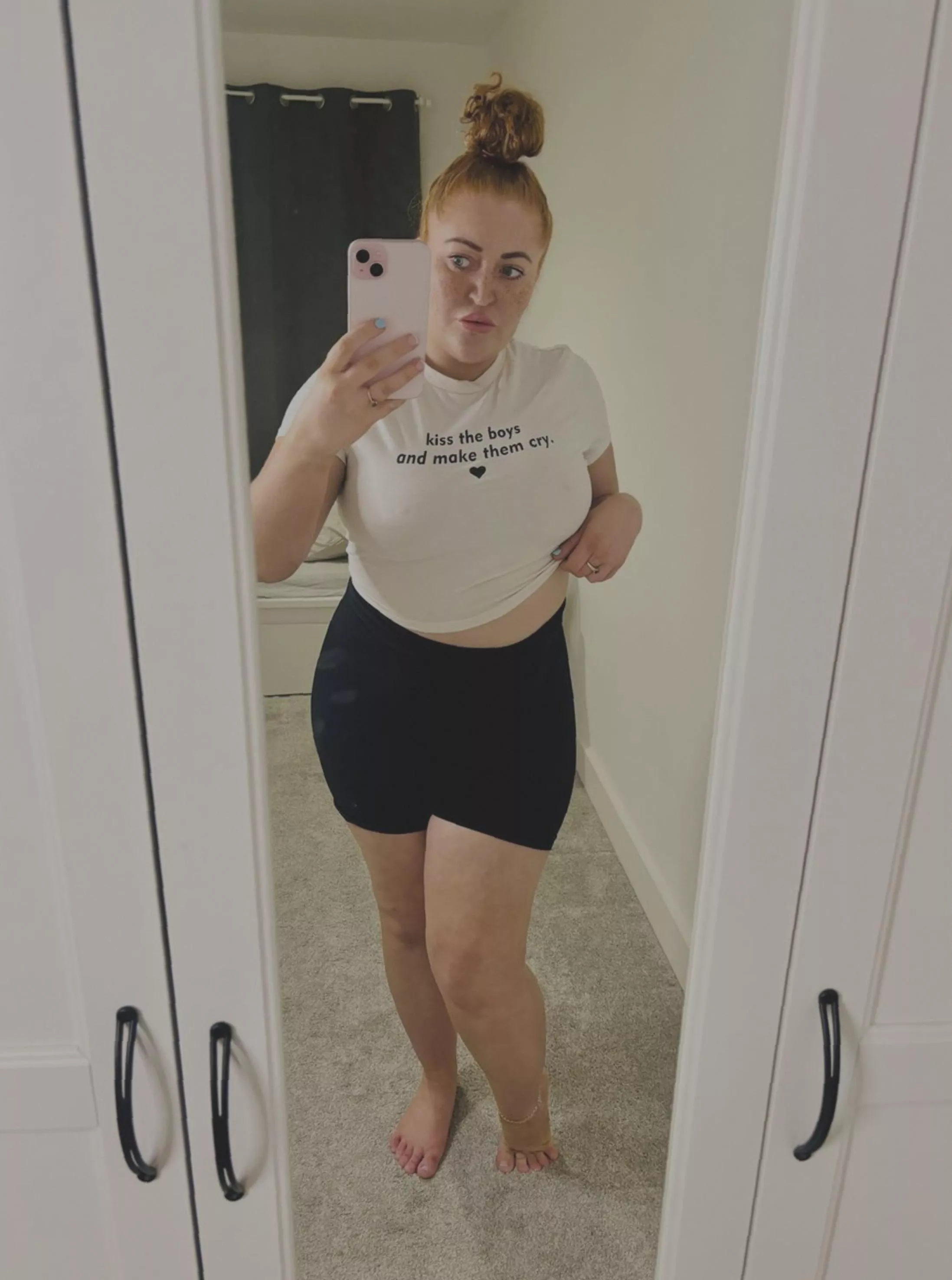 [IRTR] Looking to get some opinions on my freckles