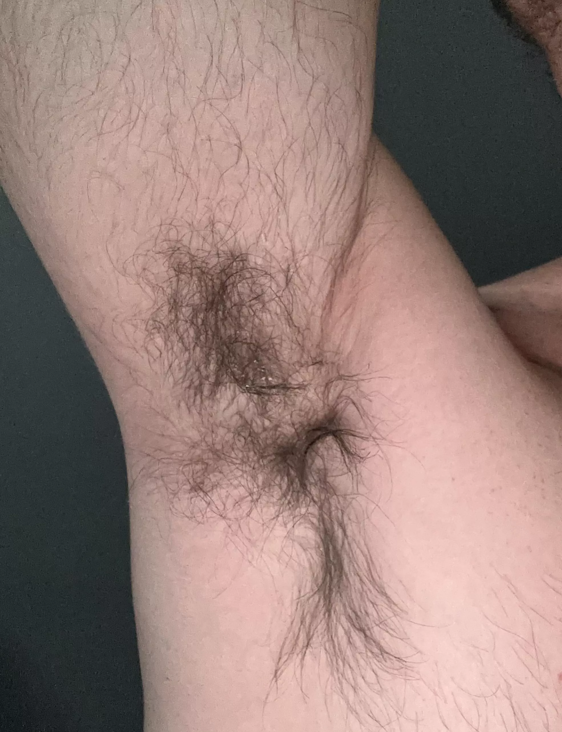 Is anyone brave enough to lick these pits?